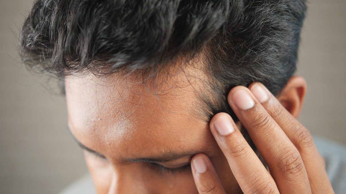 Hair Loss in Men: A Dermatologist on What Actually Works