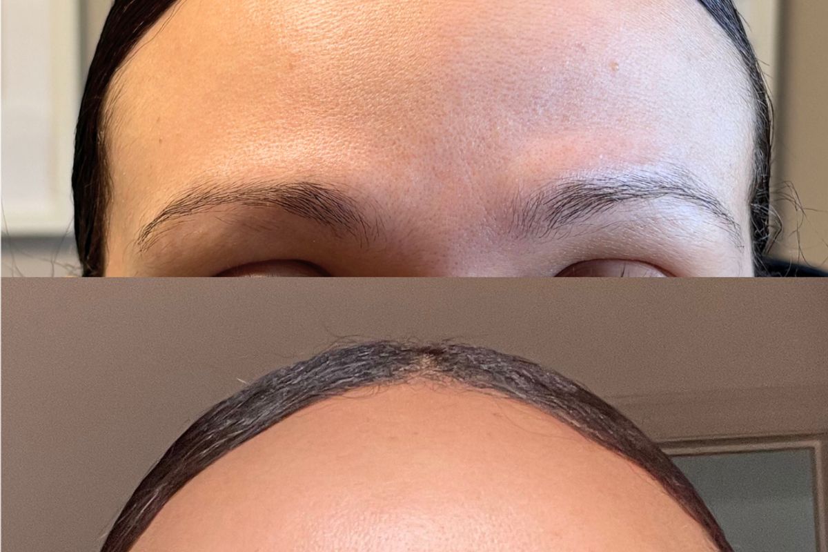 Aesthetic Nurse Katrena - Botox | Lip Filler | Medical Spa Oshawa, med spa and aesthetic clinic in Oshawa