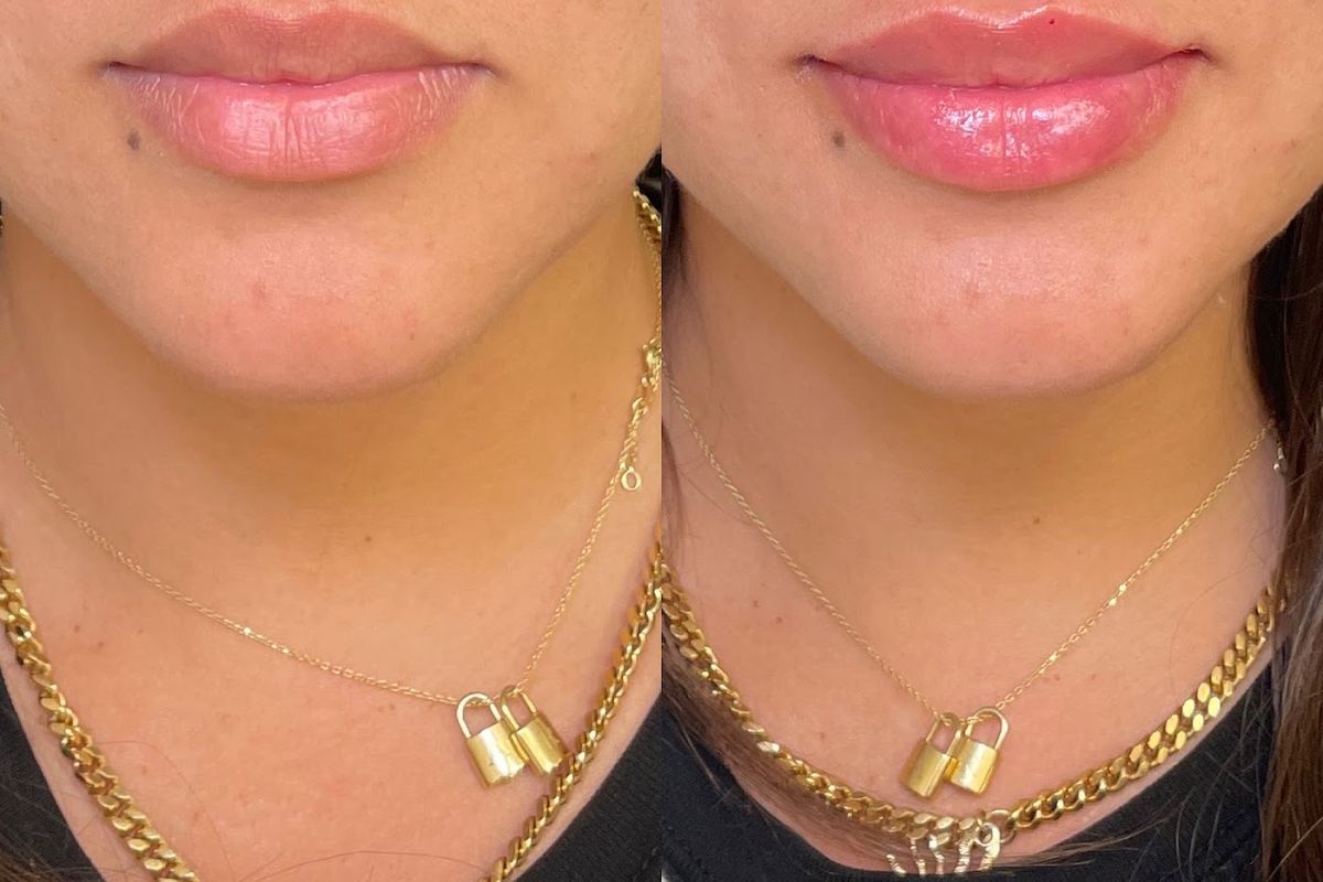 Aloha Aesthetics FL, med spa and aesthetic clinic in Orlando
