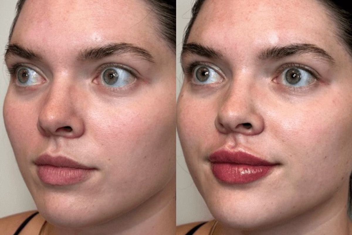ARTOX Aesthetics, med spa and aesthetic clinic in Rockwall