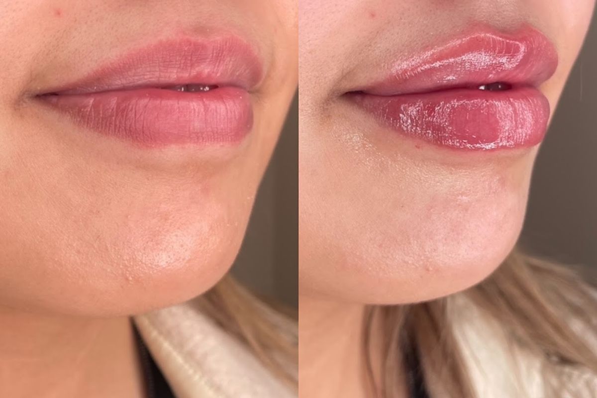Aurora 80 Aesthetics, med spa and aesthetic clinic in Vancouver