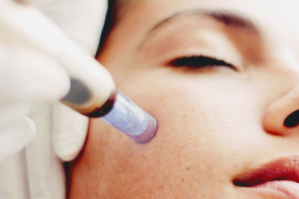 AWC Skin & Laser Studio, med spa and aesthetic clinic in Red Deer