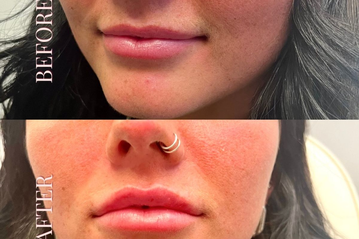 Bask on Main, med spa and aesthetic clinic in Carmel