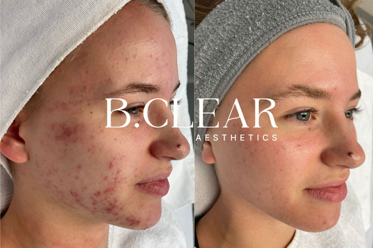 B.Clear Aesthetics, med spa and aesthetic clinic in Beaverton