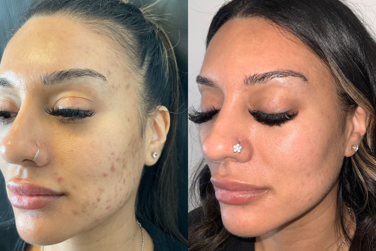 Be You Medical, med spa and aesthetic clinic in Roseville
