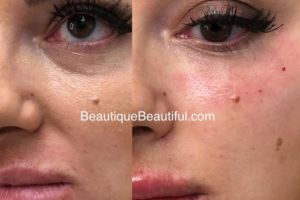 Beautique Medical Anti-Aging, med spa and aesthetic clinic in Knoxville