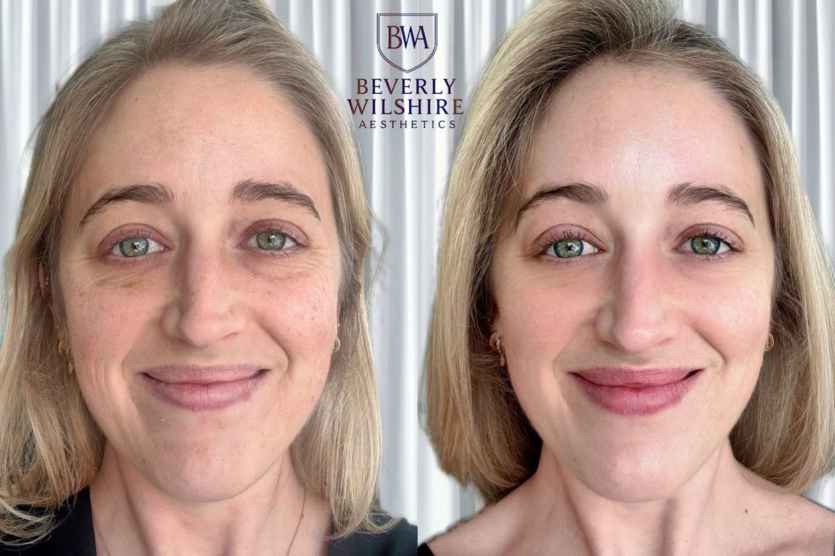 Beverly Wilshire Aesthetics Beverly Hills Medical Spa — Beverly Hills