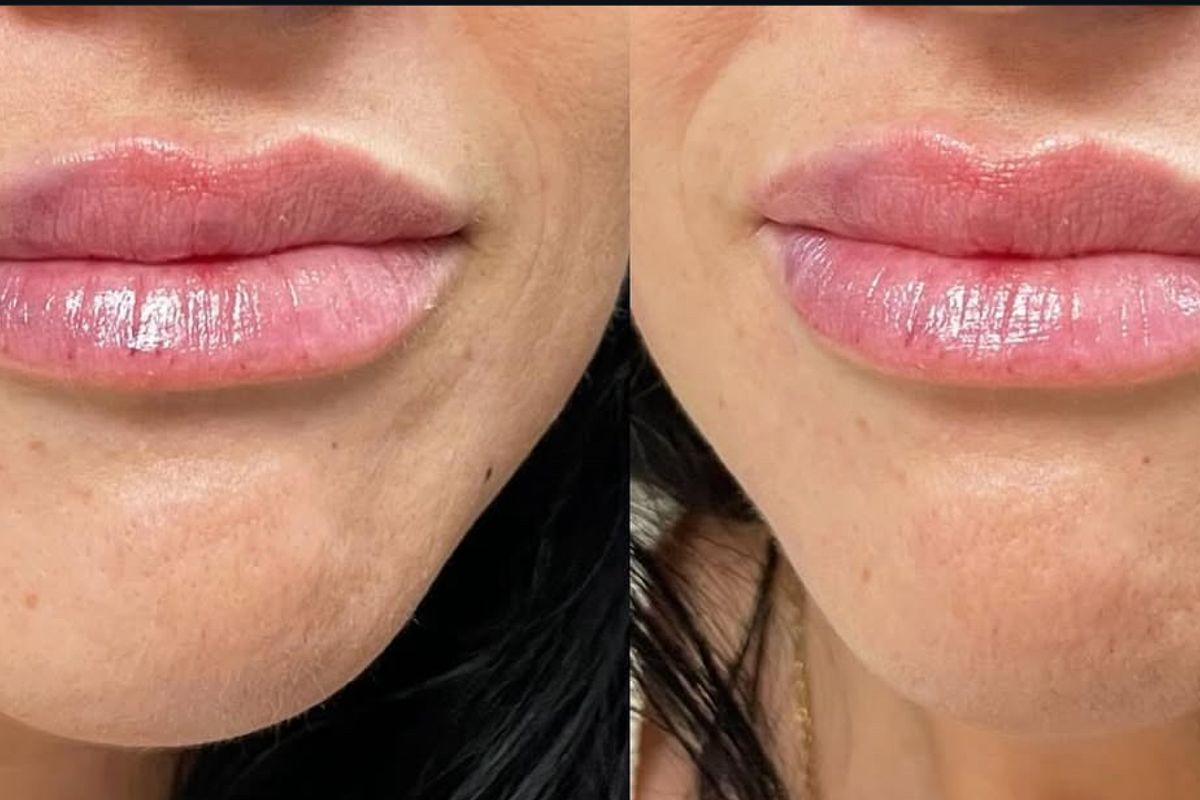 Black Diamond Aesthetics, med spa and aesthetic clinic in Scranton