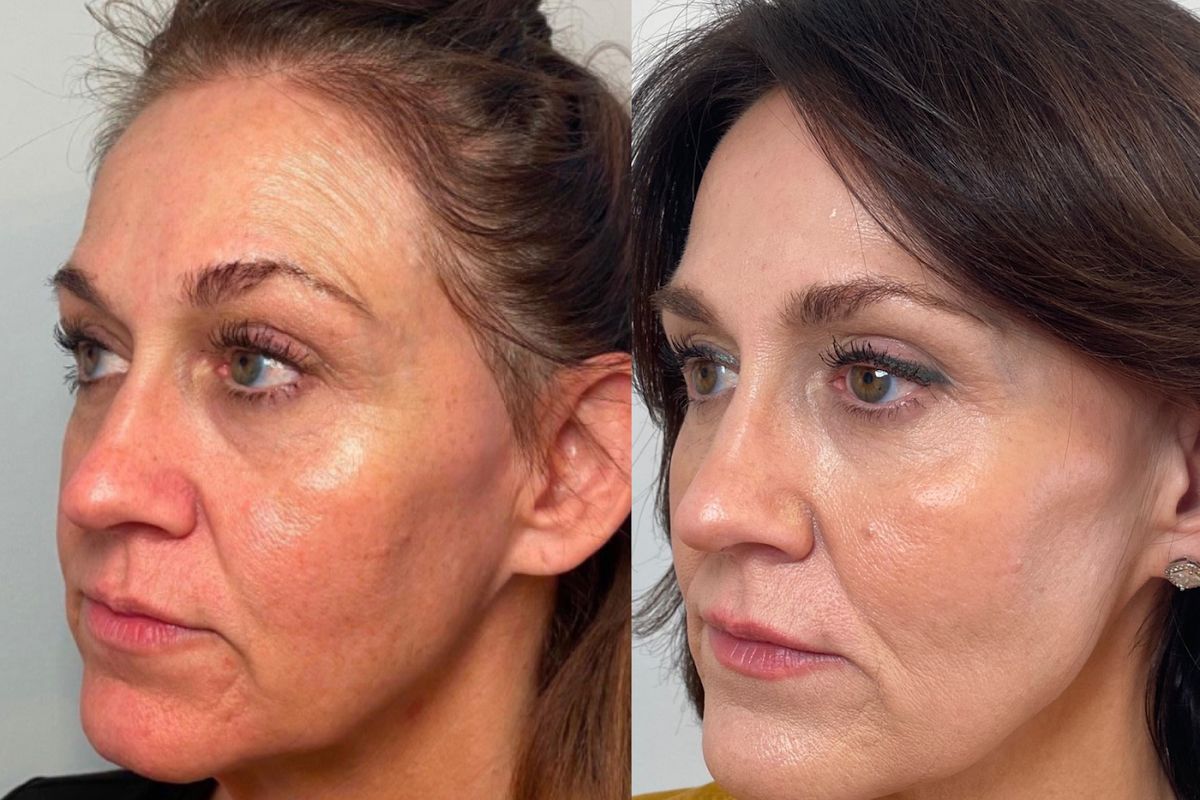 Bloom Wild Aesthetics, med spa and aesthetic clinic in Murfreesboro