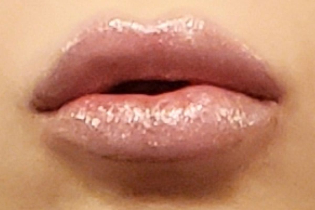 Botox Botixue — Tacoma