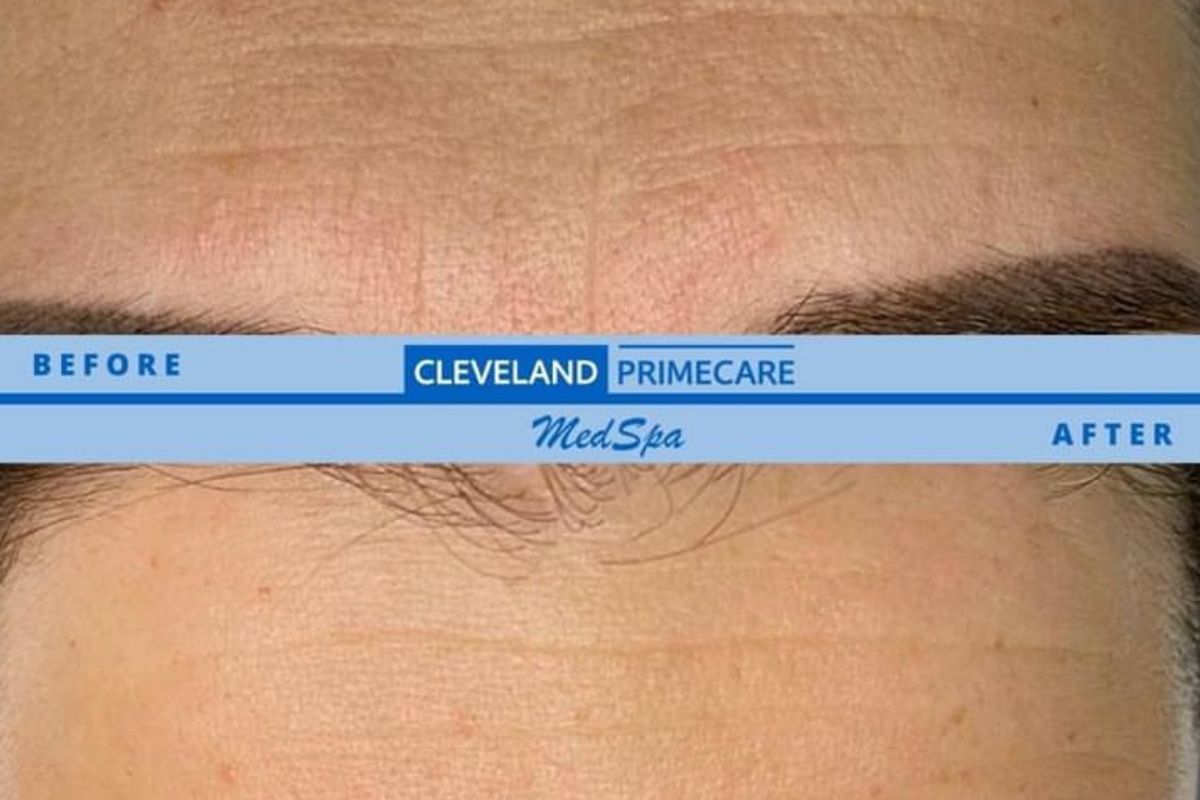 Cleveland Primecare Medspa, med spa and aesthetic clinic in Cleveland