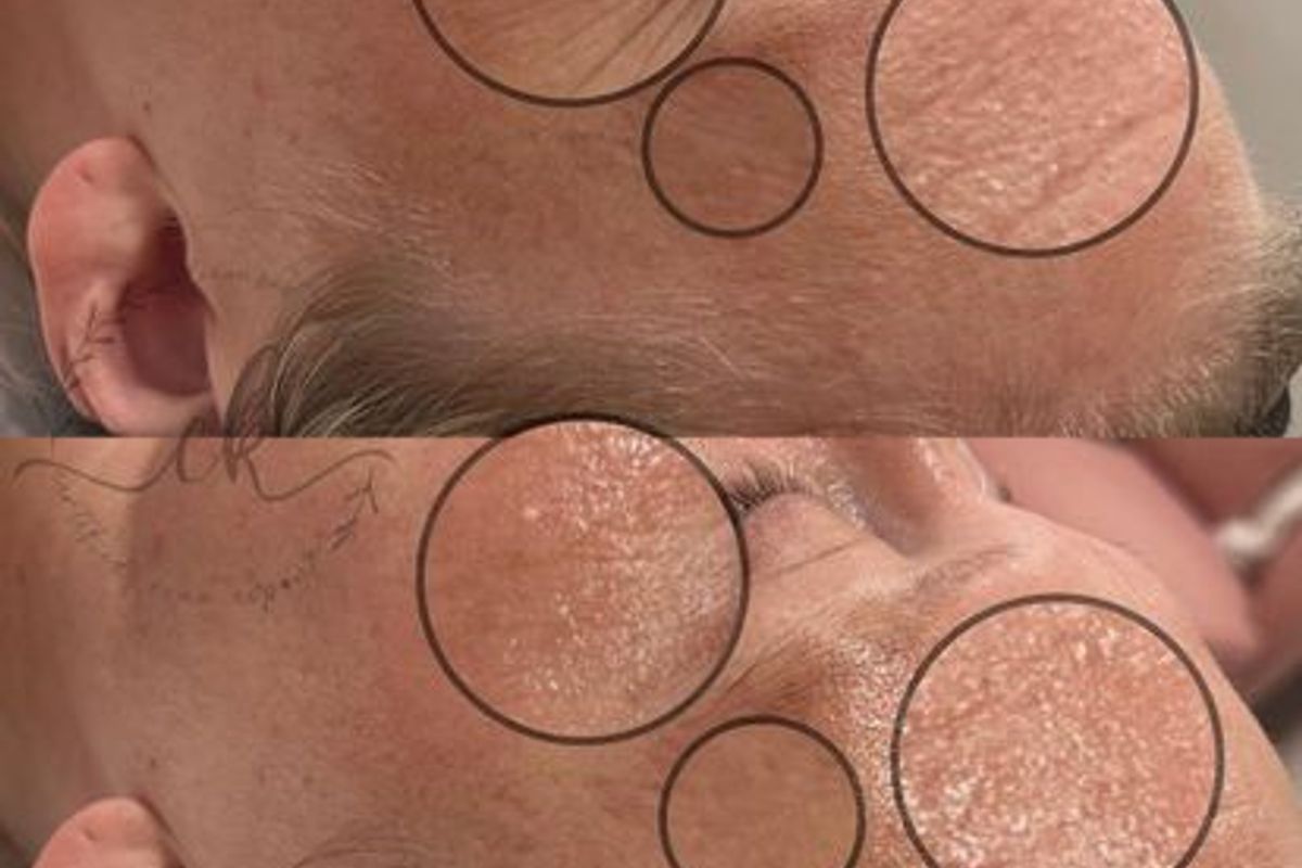 Crystal Clear Esthetics, med spa and aesthetic clinic in Evansville