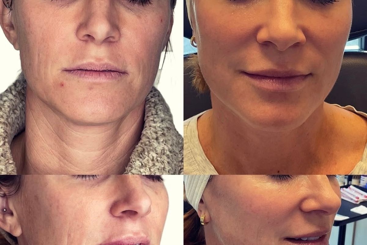 CynSational Aesthetics, med spa and aesthetic clinic in Elk Grove