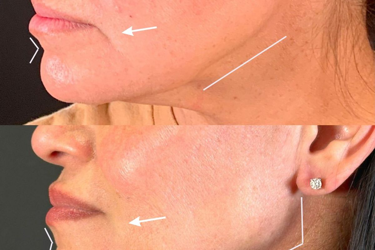 Deja Vu Med Spa, med spa and aesthetic clinic in Goodyear