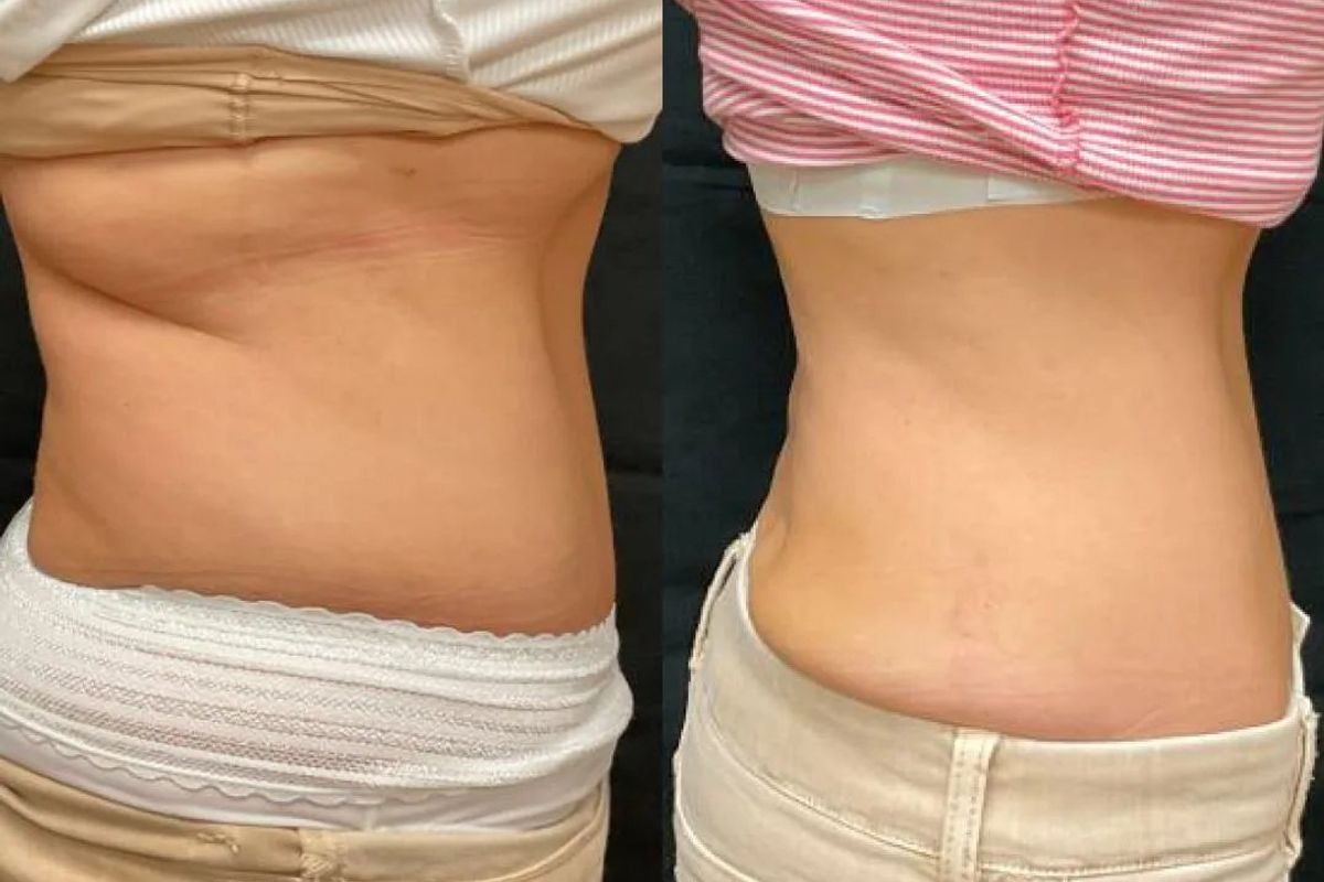 Dermatology Physicians Laser & Skincare Center, med spa and aesthetic clinic in Lancaster