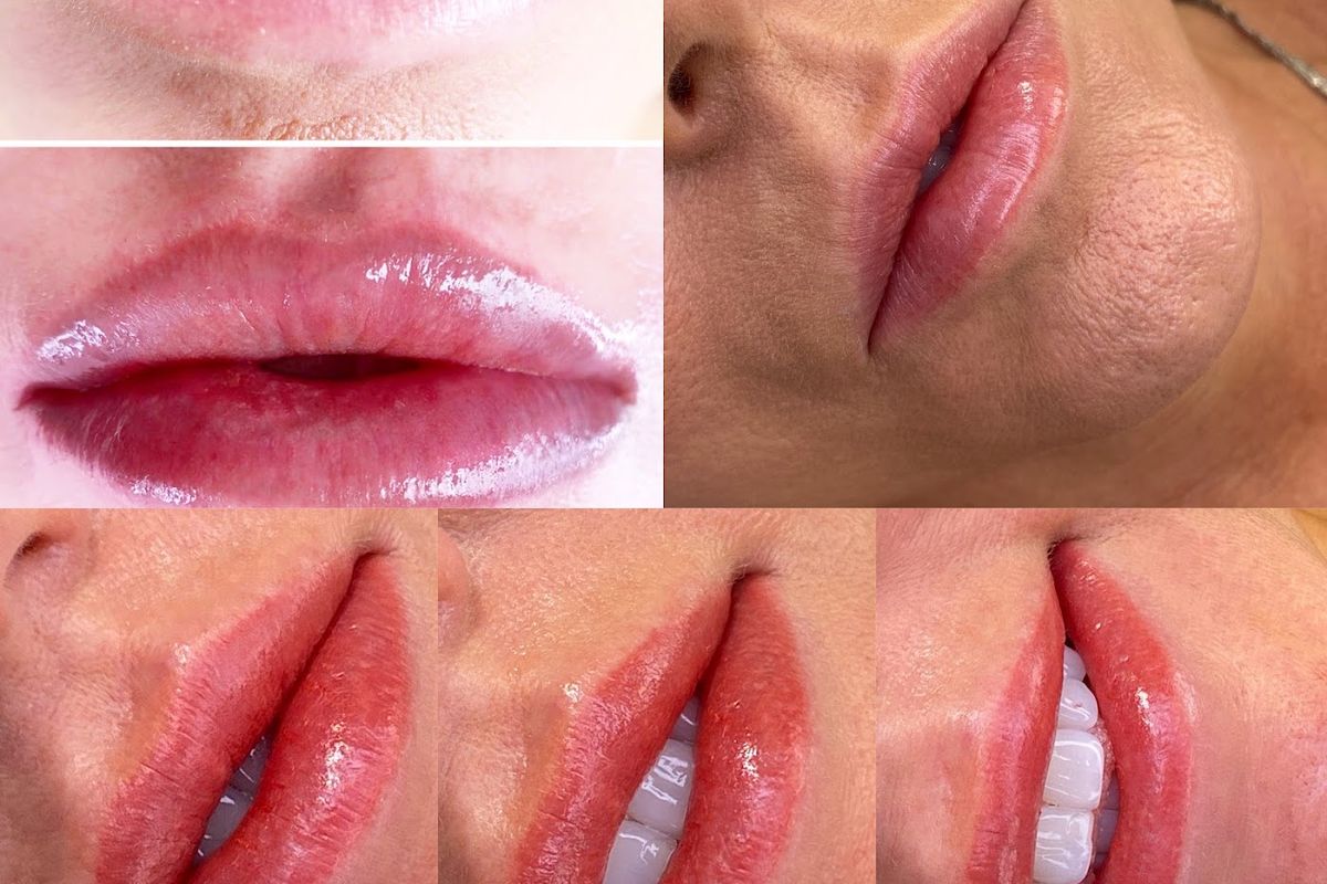 Dream Medspa, med spa and aesthetic clinic in Cherry Creek