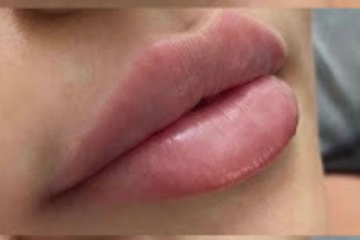 E&G Aesthetic Institute - Plastic Surgery & Med Spa Newport Beach, med spa and aesthetic clinic in Newport Beach