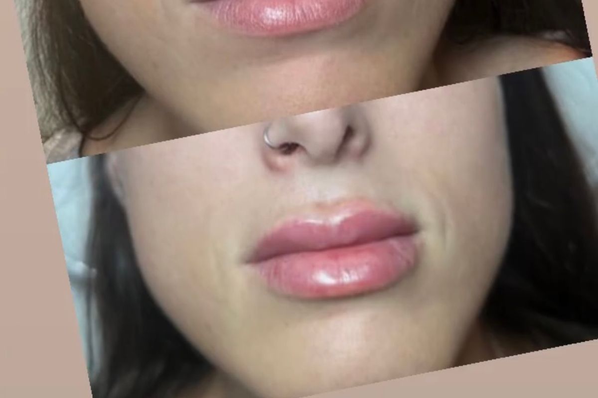 Eclipse AestheticsSI, med spa and aesthetic clinic in Staten Island
