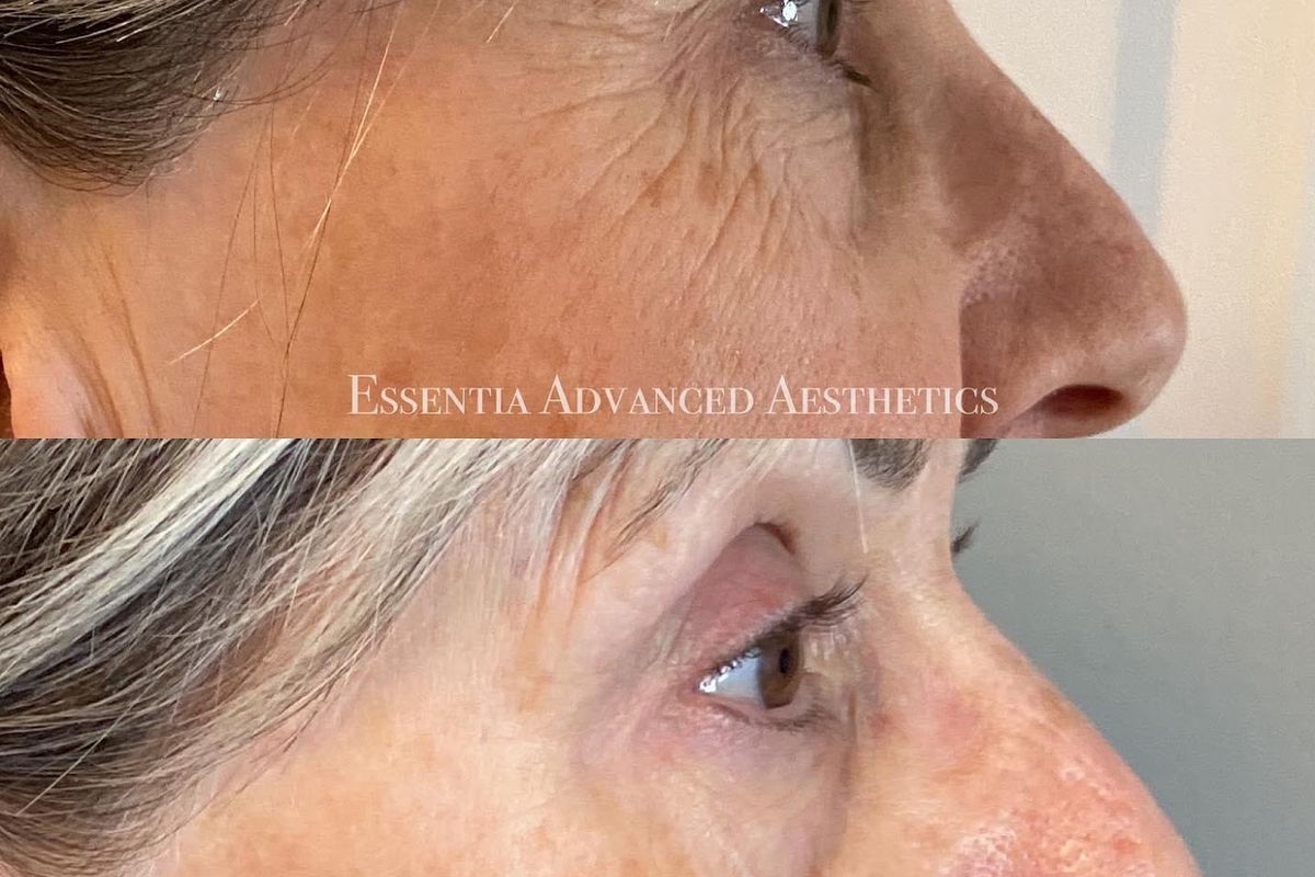 Essentia Advanced Aesthetics, med spa and aesthetic clinic in Sudbury