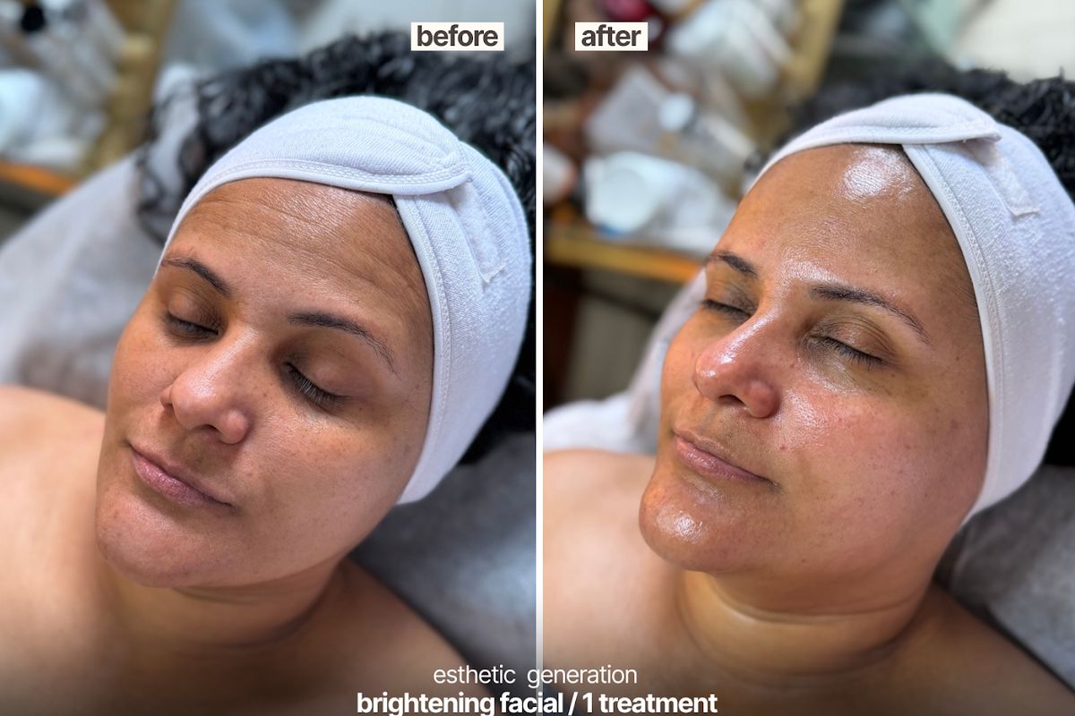 Esthetic Generation, med spa and aesthetic clinic in The Bronx