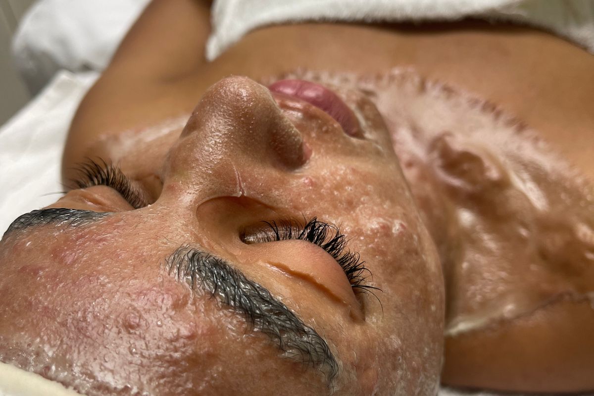 Evolution Skyn Aesthetics - Dermaplaning + Acne Expert + DMK Facialist, med spa and aesthetic clinic in Riverside