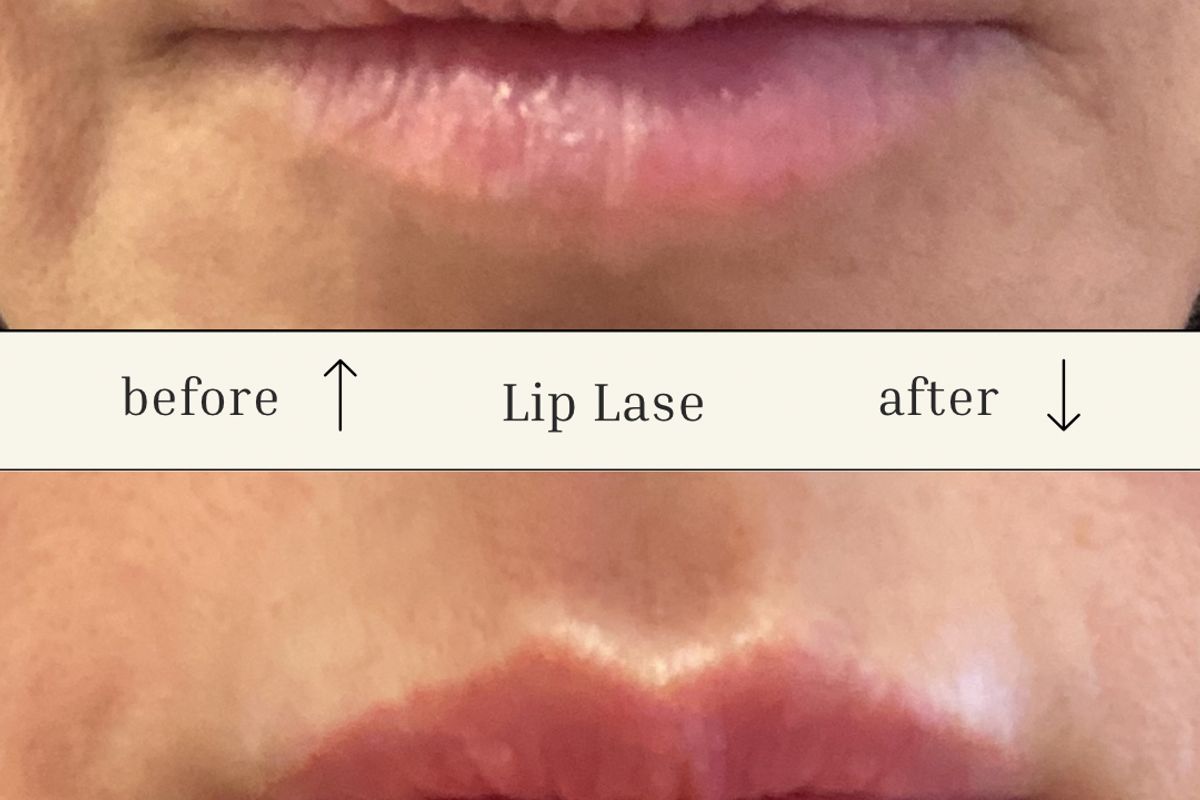Exelus Med Spa — Glendale
