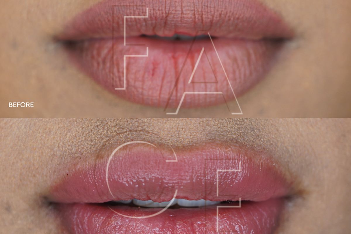 FACE, med spa and aesthetic clinic in Berkeley
