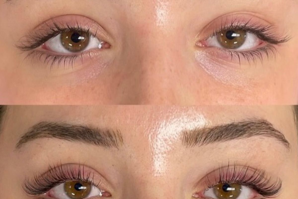 Glamour Luxe Aesthetics, med spa and aesthetic clinic in Westlake