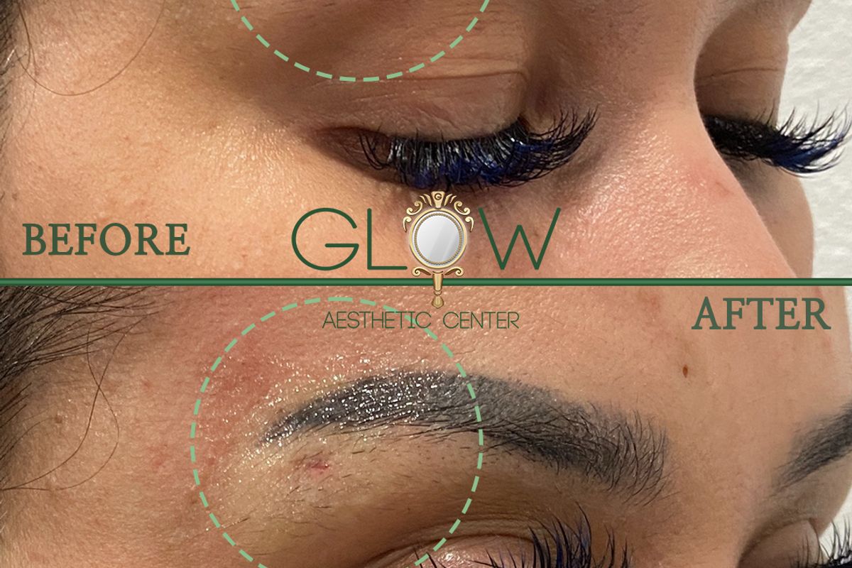 Glow Aesthetic Center Med Spa — Los Angeles, California