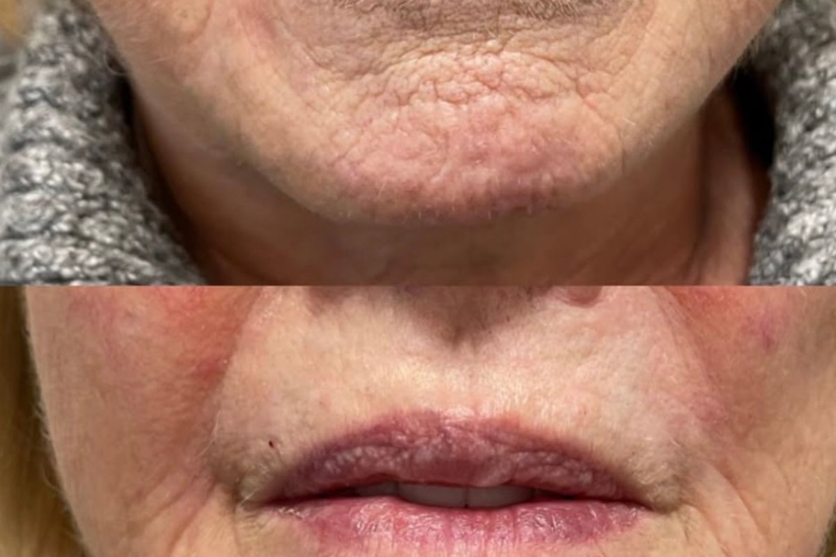 GSM MedSpa, med spa and aesthetic clinic in Whitby