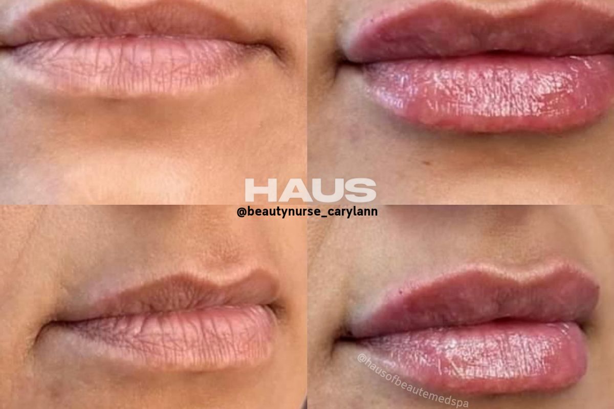 Haus of Beauté Medical Spa, med spa and aesthetic clinic in Visalia