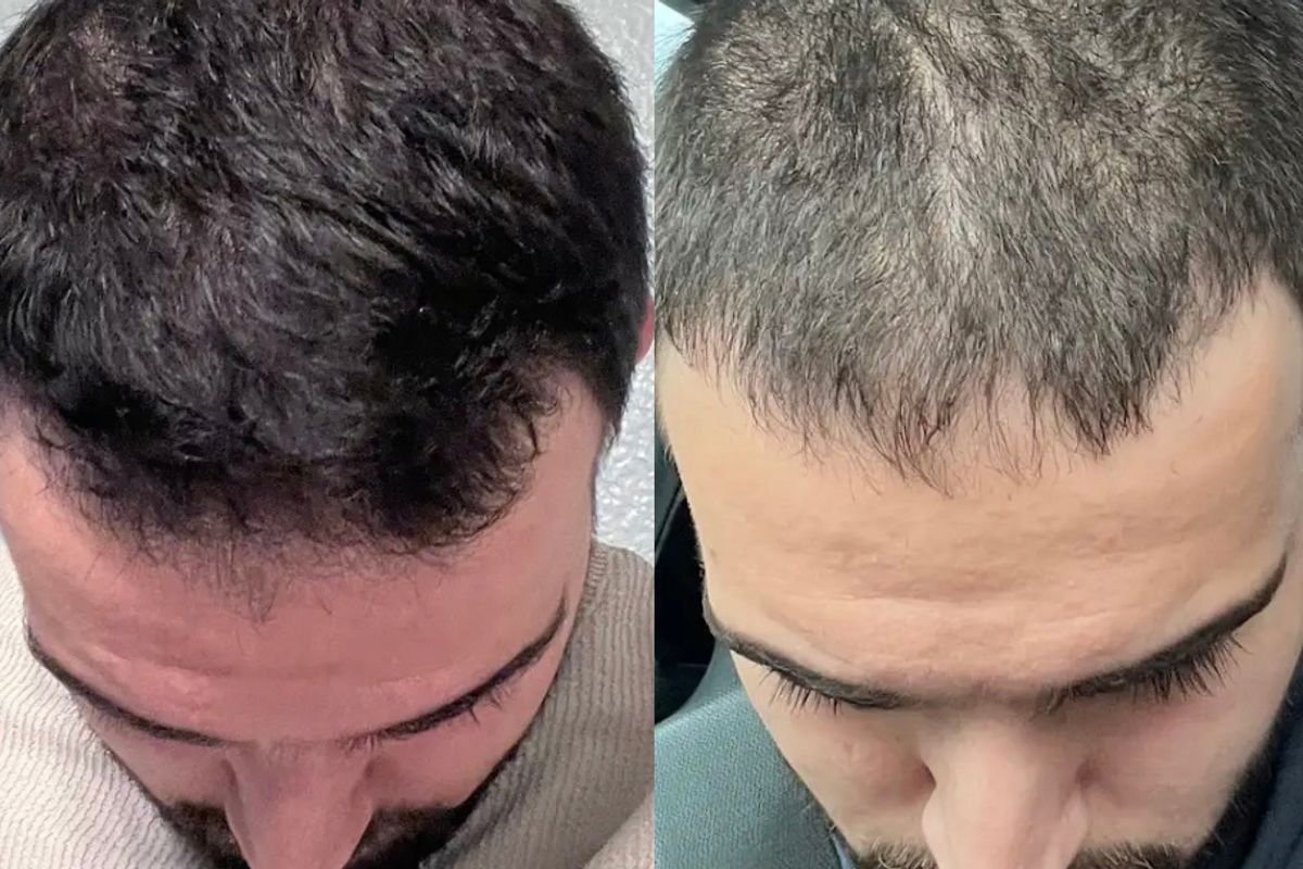 Highness Med Spa, med spa and aesthetic clinic in Allen
