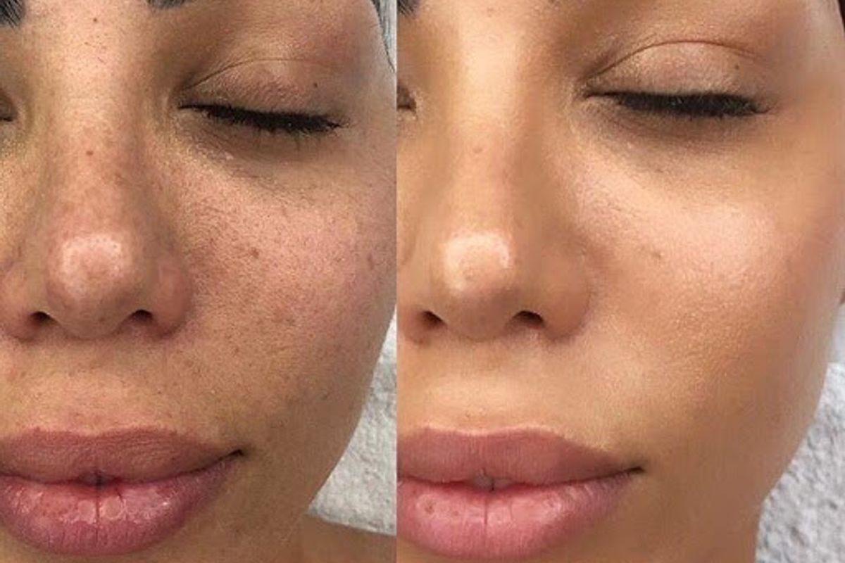 Hinsdale Vein and Laser, med spa and aesthetic clinic in Hinsdale