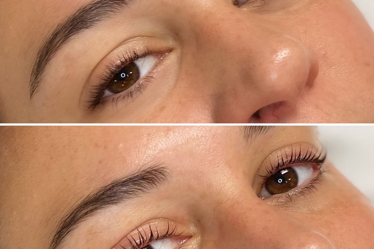 Holladay Spa, med spa and aesthetic clinic in Charlottesville