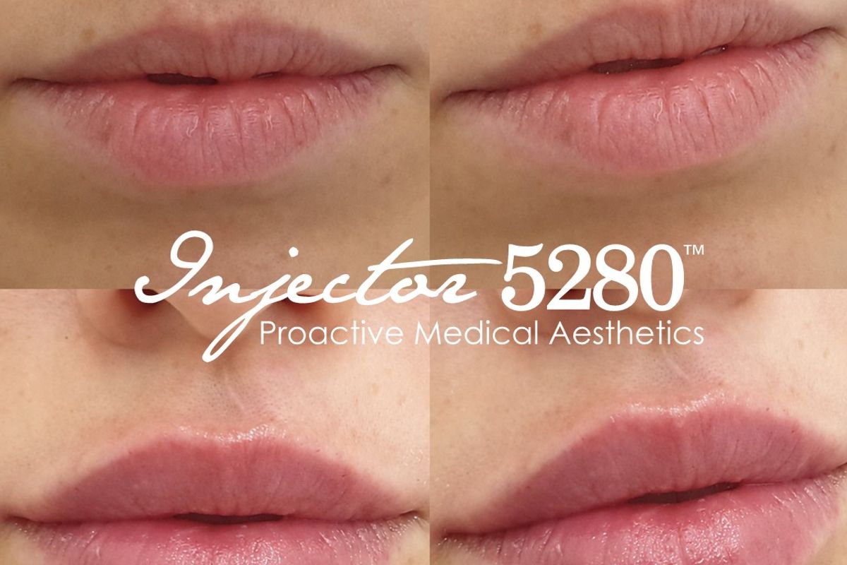 Injector 5280 — Denver