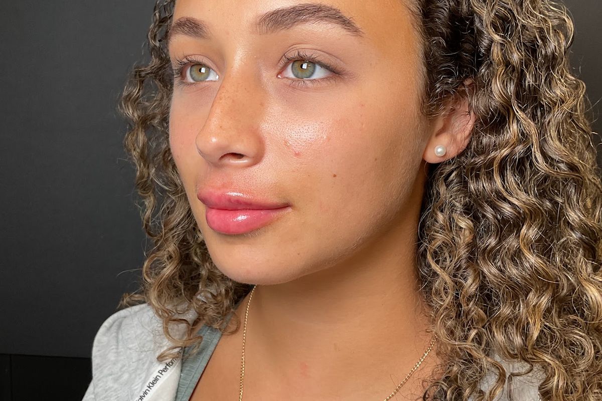 Island Aesthetics, med spa and aesthetic clinic in Buffalo