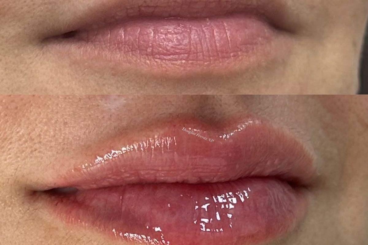 Juves Aesthetics & Cosmetic Procedures, med spa and aesthetic clinic in Kissimmee