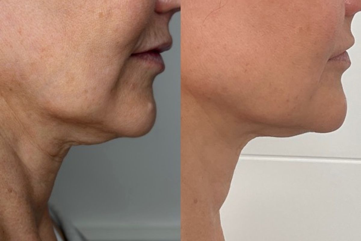 Kane Medical Aesthetics — Calgary