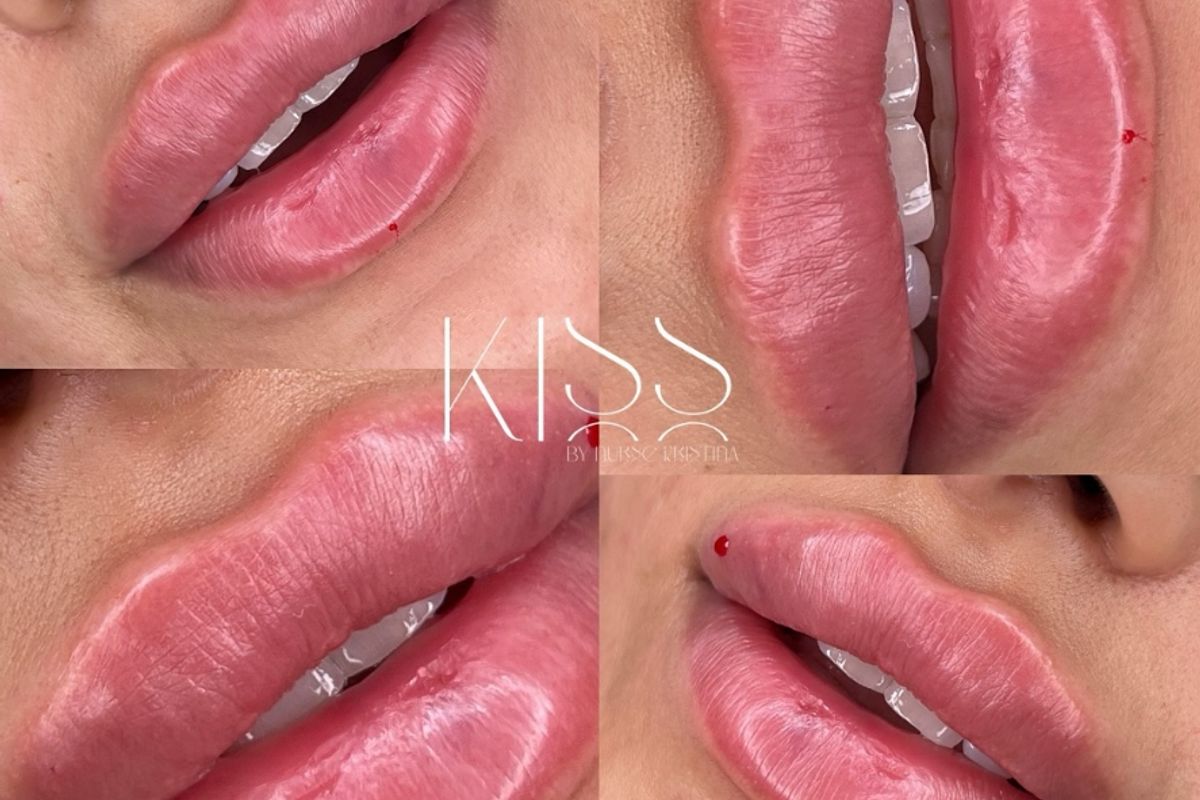 Kiss Medical Aesthetics Inc., med spa and aesthetic clinic in Windsor