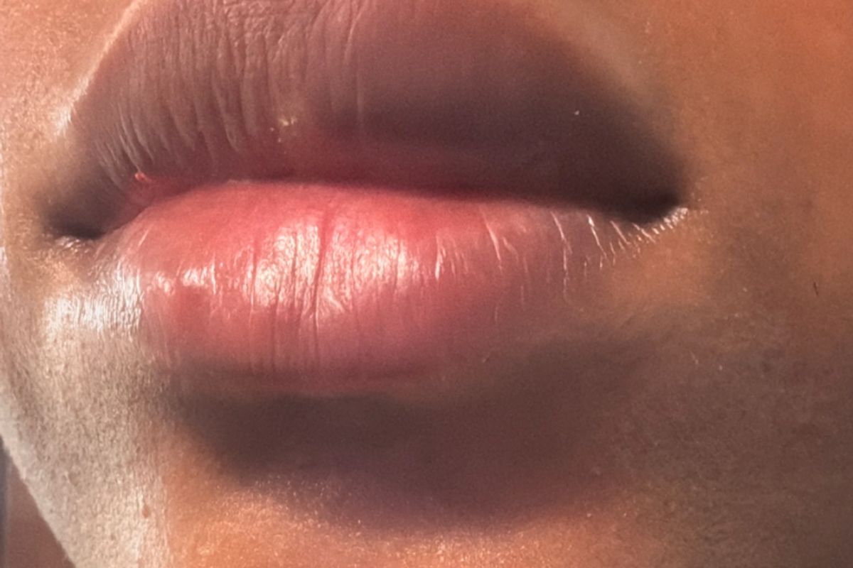Lips by Tif x District Laser, med spa and aesthetic clinic in Washington