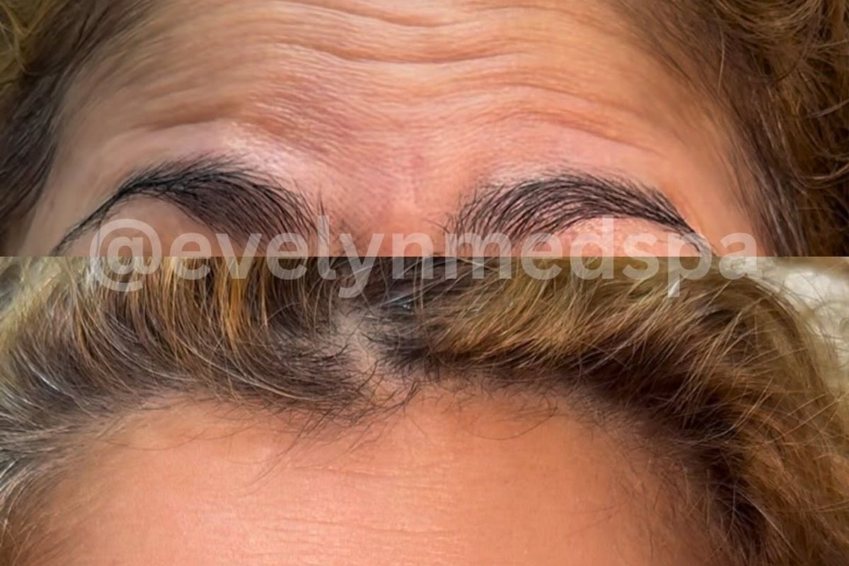 Lumen Beauty & Wellness, med spa and aesthetic clinic in Yonkers