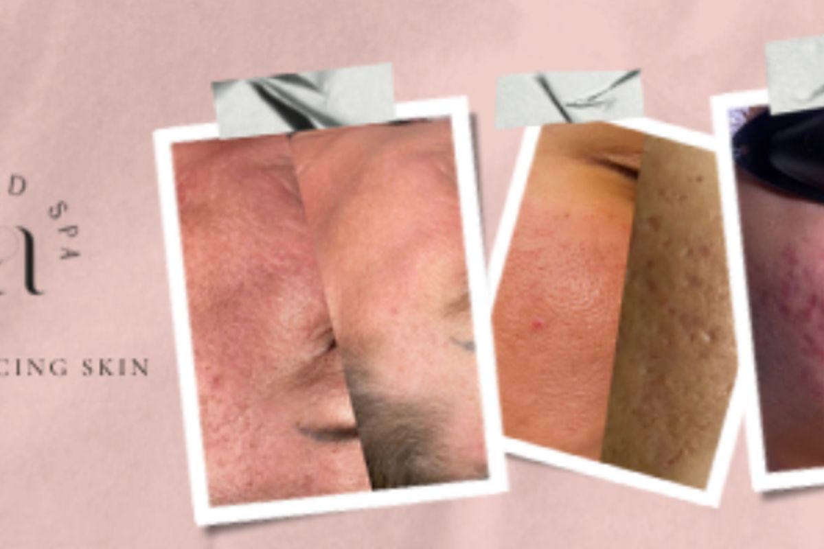 Luna Med Spa, med spa and aesthetic clinic in Kansas City