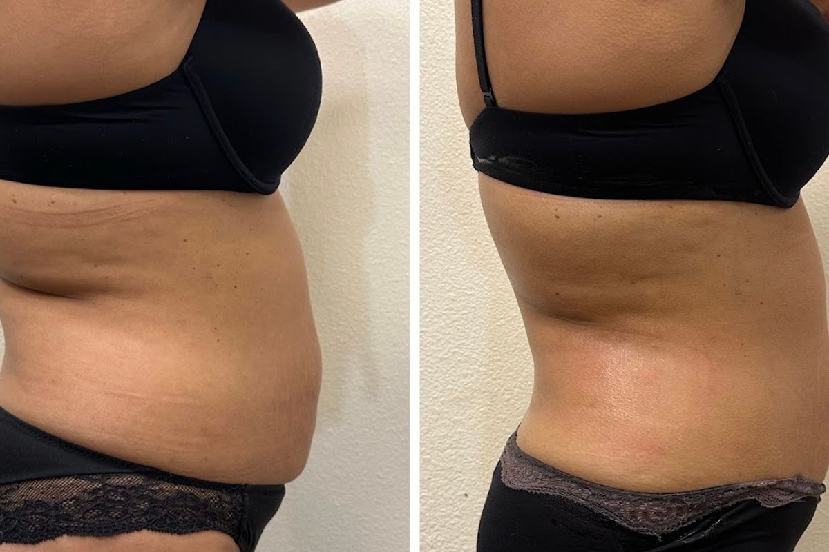 Lux beauty, med spa and aesthetic clinic in Modesto