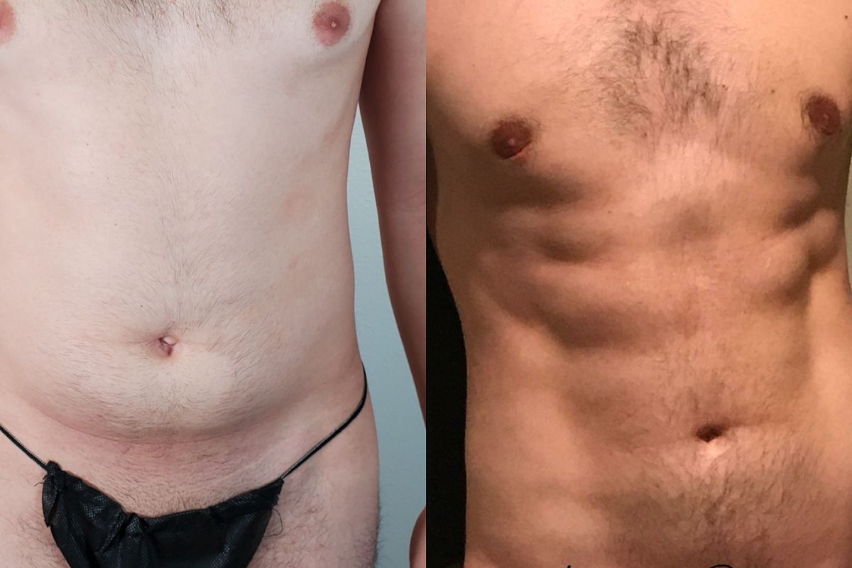 Luxe Aesthetic Surgery & Medical Spa - Hi-Definition Liposuction, Breast Augmentation, Hair Restoration &Transplant, med spa and aesthetic clinic in Ventura