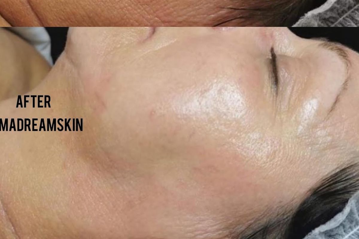 M.A DREAM SKIN — Pasadena