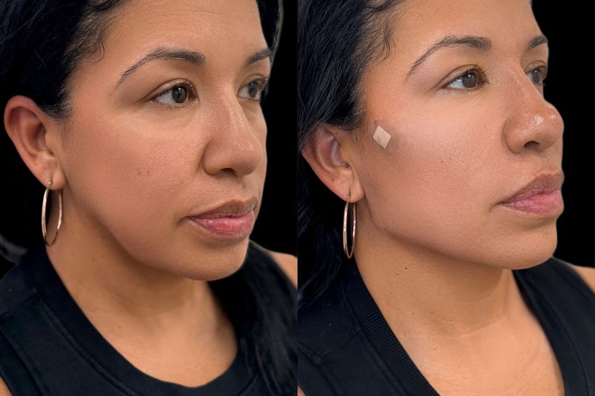 Med Spa NYC: Beso Aesthetics — New York