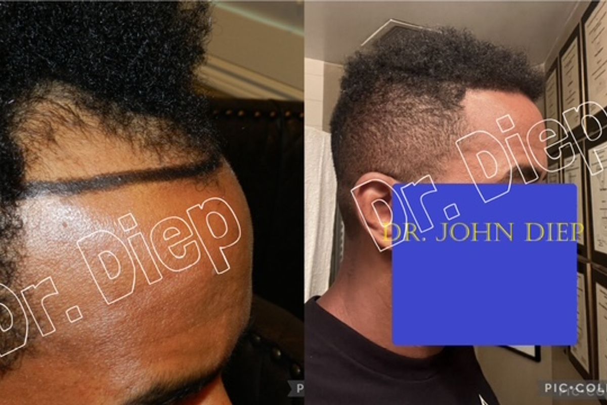Medical Hair Transplant & Aesthetics, med spa and aesthetic clinic in Los Gatos