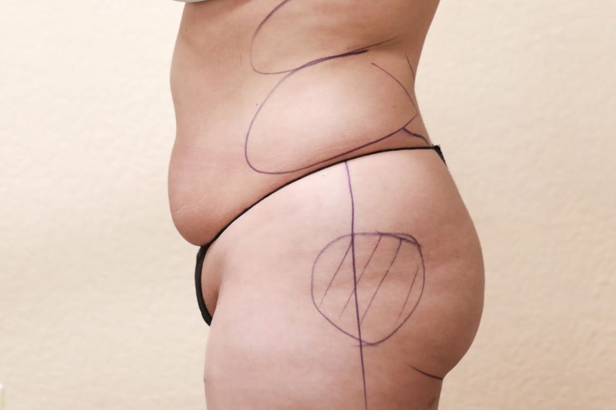 Milk and Honey Body Cosmetic Surgery, med spa and aesthetic clinic in Las Cruces