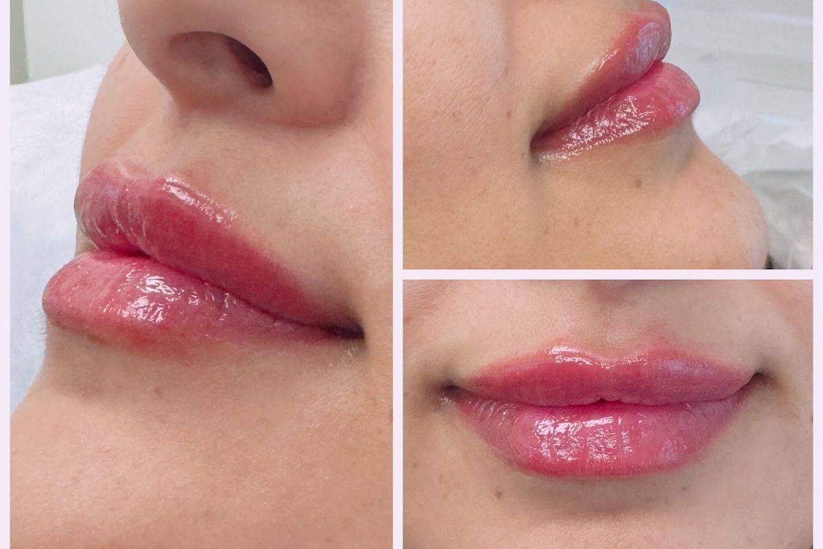 MVP Medical Aesthetics, med spa and aesthetic clinic in Pickering