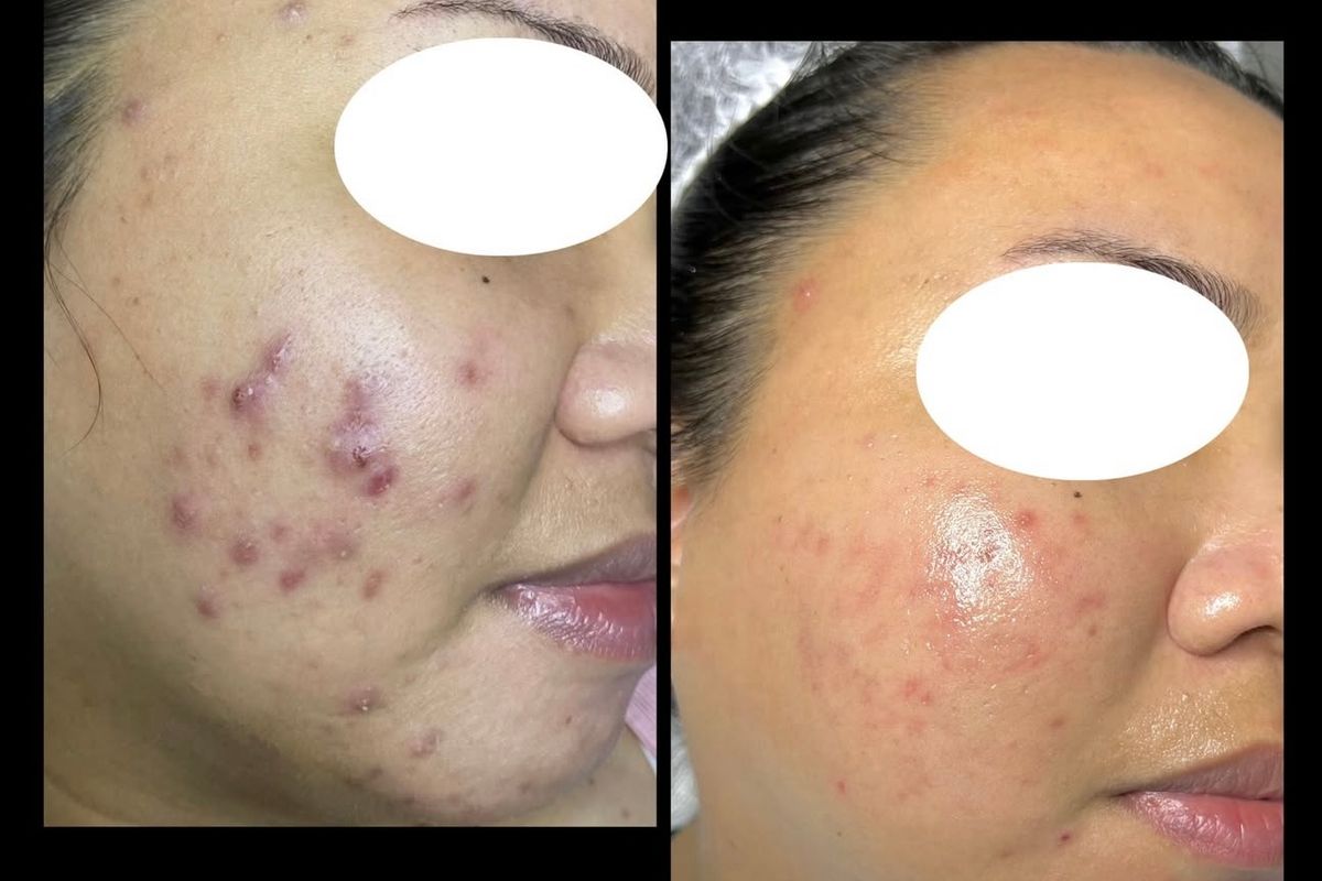 MyrAesthetics, med spa and aesthetic clinic in Kissimmee